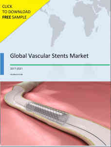 Global Vascular Stents Market